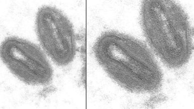 Apekopper: – Fikk sjokkdiagnose etter ferietur