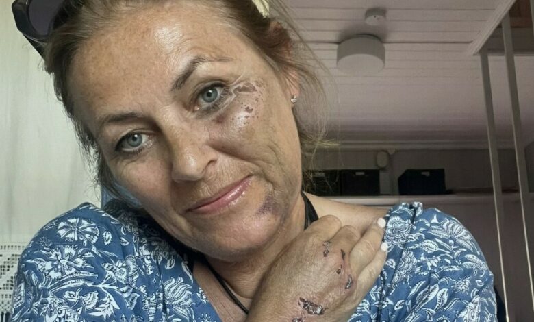 Jeanettes feriemareritt: – Blir veldig sårbar