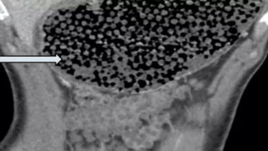 Dette er Norges medaljemål