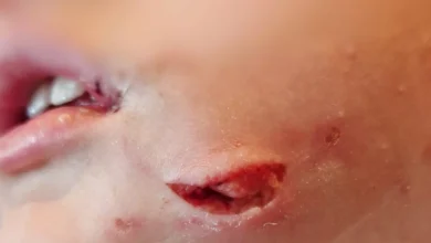 Hvordan Senegal planlegger å stoppe Haaland