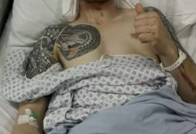 Deler bilder etter skrekkskade