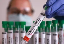 Amerikansk helsemyndighet erklærer hantavirus som «nivå 3»-krise