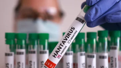 Amerikansk helsemyndighet erklærer hantavirus som «nivå 3»-krise