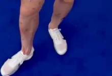 Blodig drama